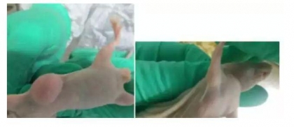 裸鼠成瘤尝试 裸鼠成瘤尝试