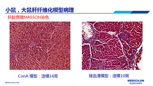 8b1a4e10-3122-4151-b938-e17eb96b5d71 ConA和猪血清诱导的肝纤维化模型