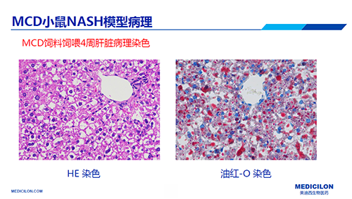 d28c4d5e-f7c9-4fcb-9cc1-c55c7fd79f0c 幼鼠NASH模型