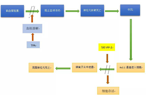脑卒中形成机造 脑卒中形成机造