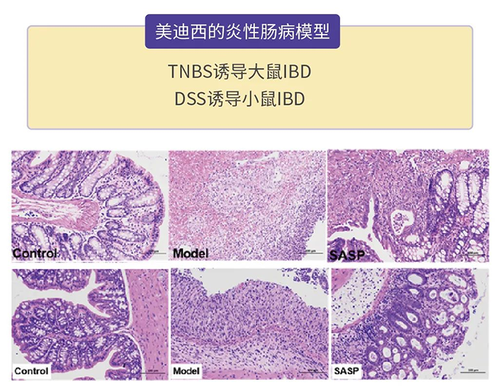 兰科博弈RankBet的炎性肠病模型.png 兰科博弈RankBet的炎性肠病模型.png